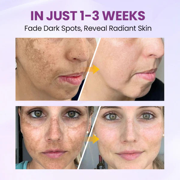 Biancat® RadiantClear Blemish & Brightening Serum