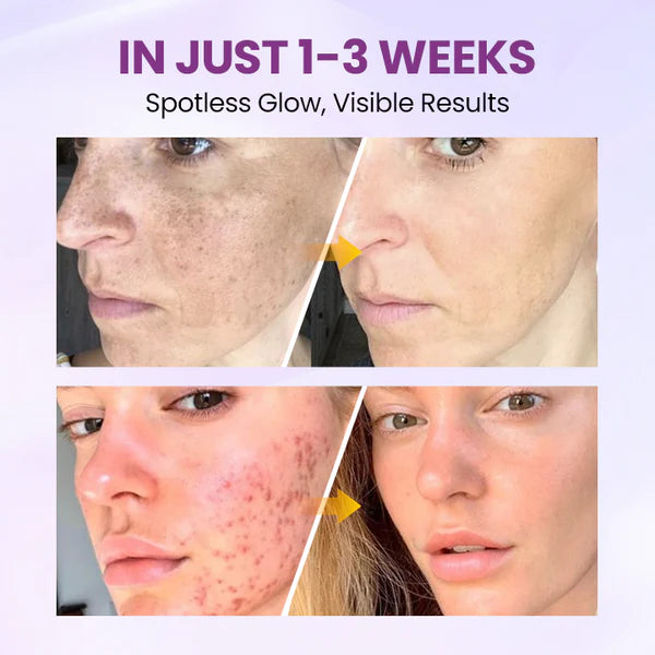 Biancat® RadiantClear Blemish & Brightening Serum