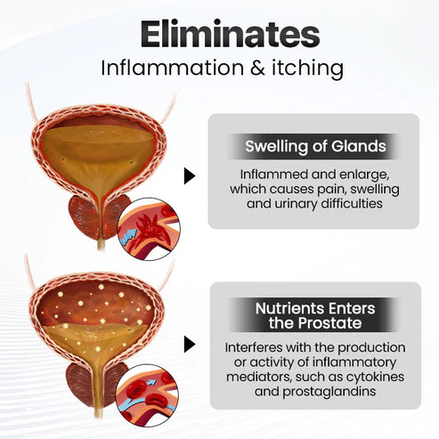 Biancat™ BeeBreathe Prostate Care Nasal Therapy Inhaler (Bee No.1) (NEW 2)