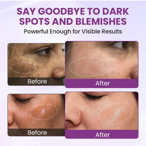 Biancat® RadiantClear Blemish & Brightening Serum