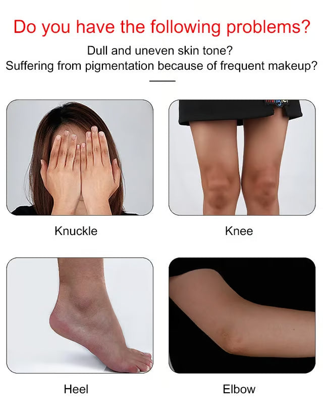 LAST DAY PROMOTION 40% OFF NOW ! Whitening Cream Body Cream Whitening Repair-Recommended by the American Esthetic Association